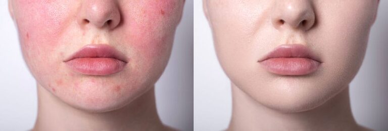 Before and after image